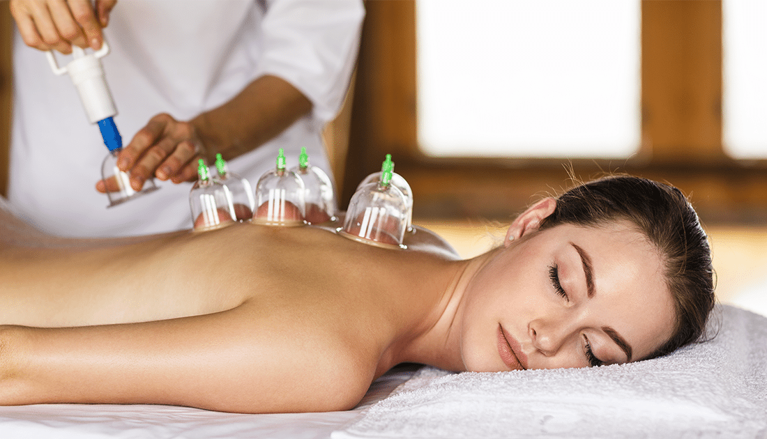 A woman receiving cupping therapy on her back, featuring cupping cups, aligning with SteelFit USA's health and wellness ethos.